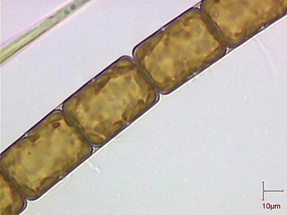  p>中肋骨条藻隶属硅藻门,中心硅藻纲, a href="#" data-lemmaid="