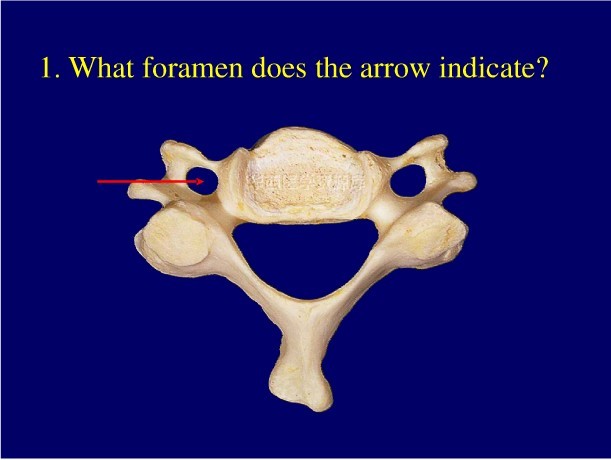  p>颈椎横突孔(transverse foramen)是指在颈椎椎体侧面,由 a target=