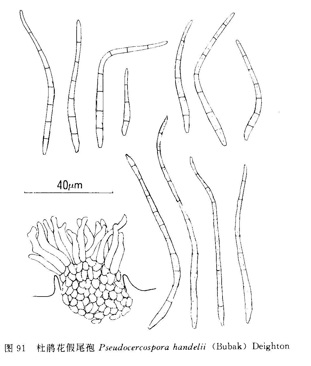 p>杜鹃花假尾孢,真菌.斑点生于叶的正背两面,圆形至不规则形,直径 1.