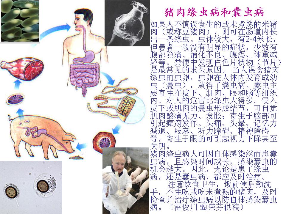 猪肉绦虫