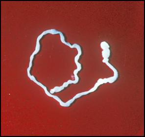 阔节裂头绦虫病