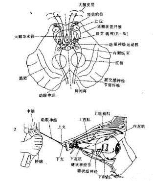 动眼神经麻痹