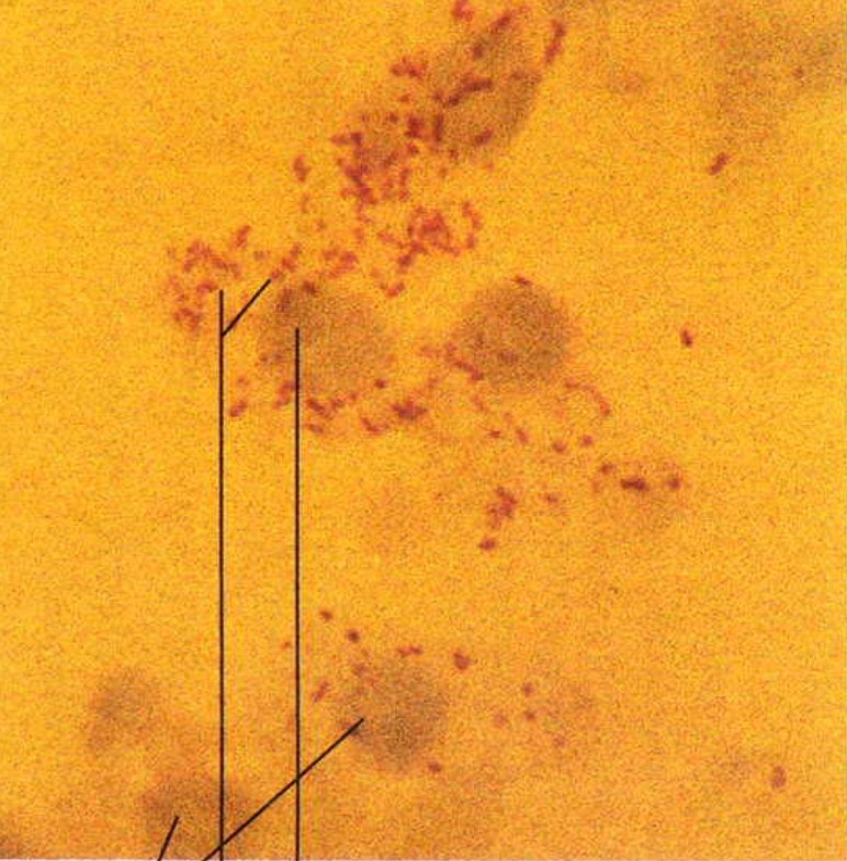 data-lemmaid="147527">微生物 /a>形态结构和性状与立克次氏体极相似
