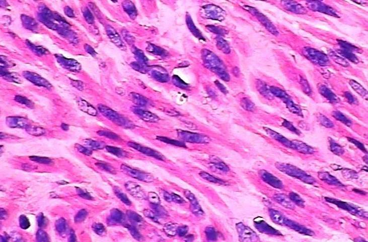 苏木精-伊红染色