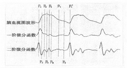  p>脑血流图仪是描记脑组织血流量随心动周期变化的一种仪器.