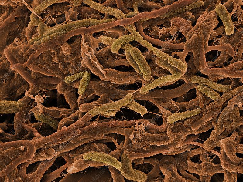 如斯坦福大学科学家发现的古细菌,最适生长温度为100℃,80℃以下即失