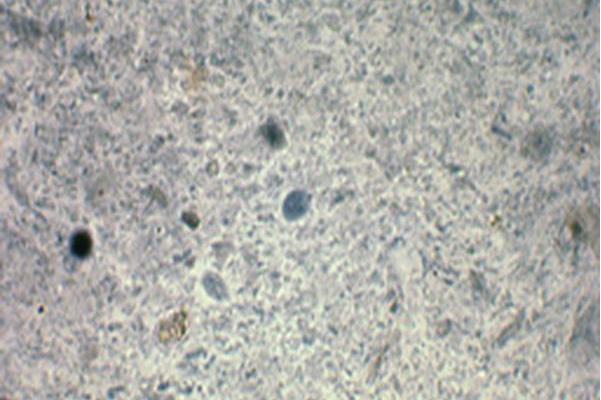 微小内蜒阿米巴包囊