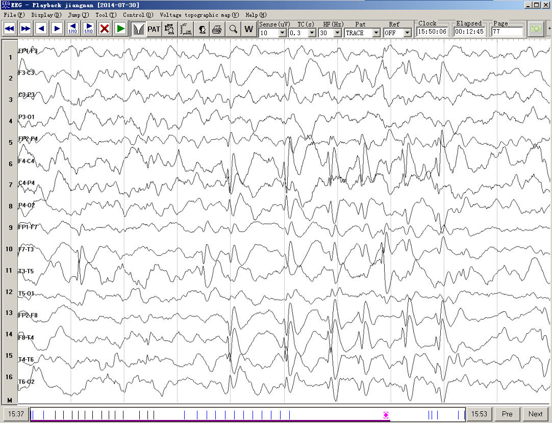 用于脑电信号的提取,放大,滤波,记录,分析,回放等.
