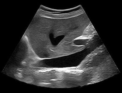 大学 /a>最新的医学影像处理的科研成果迅速转化成医学图像处理软件
