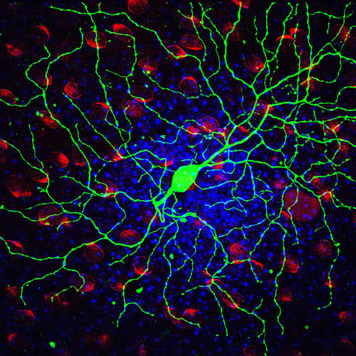  p data-id="gnbiwartig">神经节细胞是多极 a target="_blank" href=