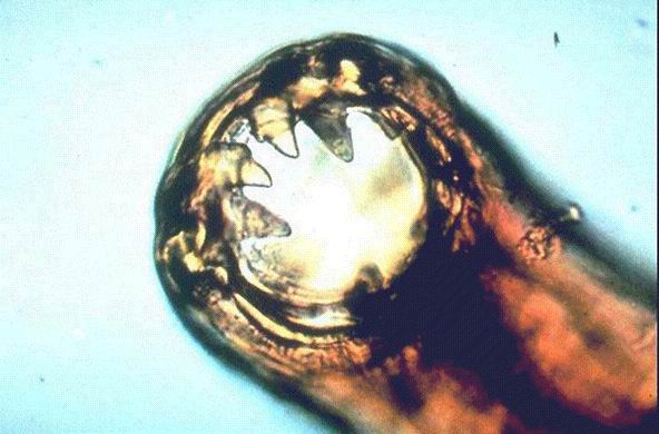  p>十二指肠钩口线虫(ancylostoma duodenale),简称为十二指肠钩虫,寄