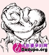 25%,称为胎儿横位.