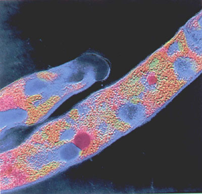  p>弯曲杆菌 ( a>campylobacter /a>),呈逗点状或s形,微需氧, a href=