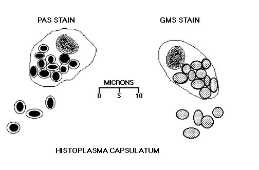 荚膜组织胞浆菌