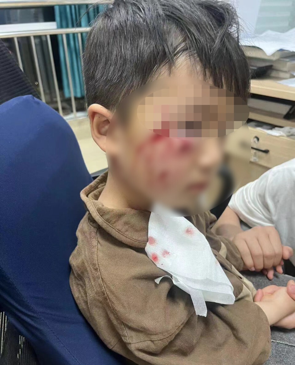 2024年4月21日新野男童被恶犬咬伤事件