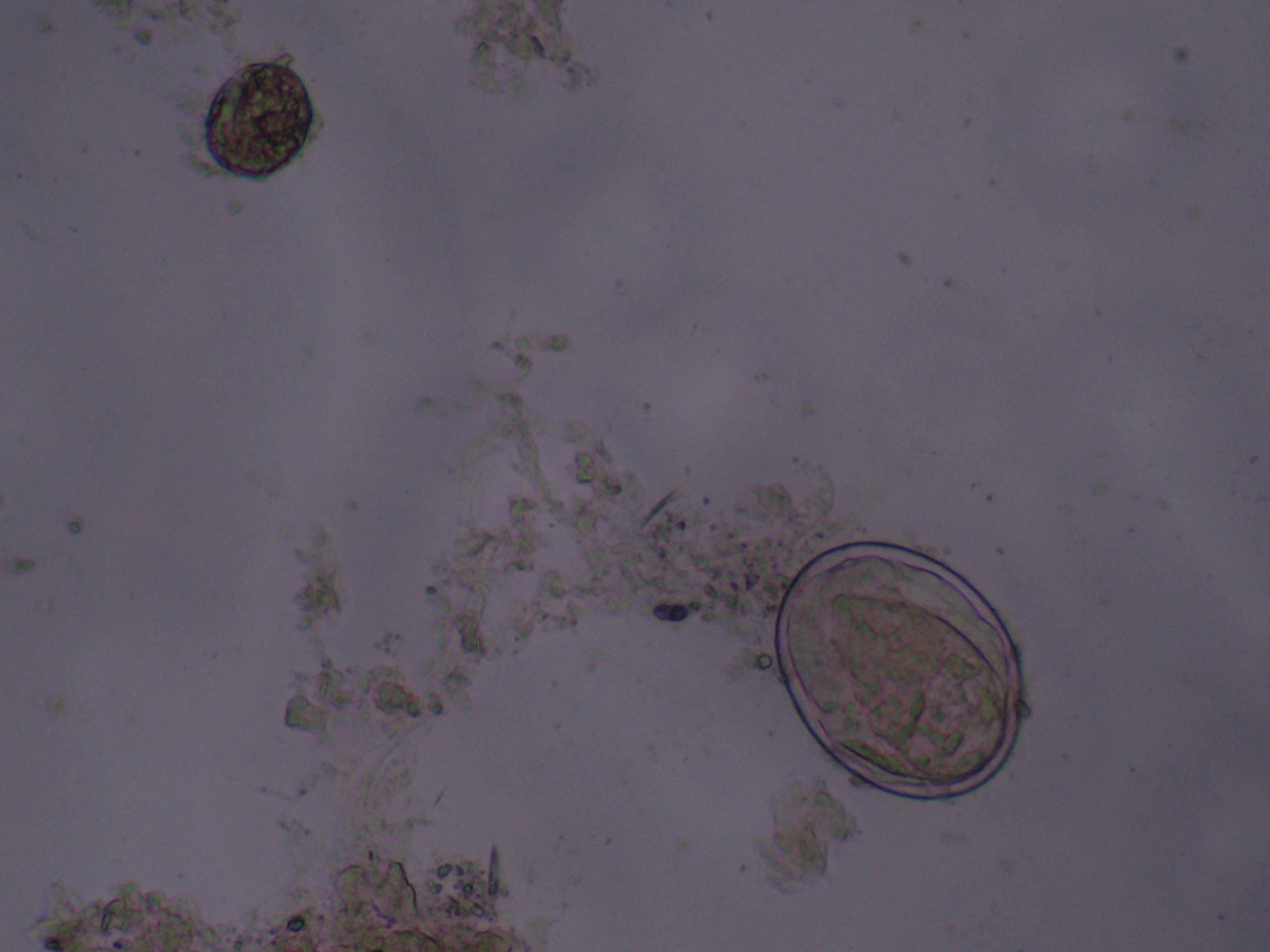 id="417982">血吸虫 /a>寄生于多数脊椎动物,寄生人体的有3种︰埃及 a