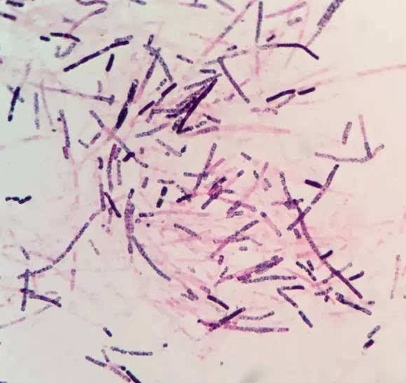  p>曾称魏氏梭菌或 a target="_blank" href="/item/产气荚膜杆菌