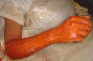 磺胺米隆为白色至淡黄色结晶或结晶性粉末;有醋酸臭;水溶液呈弱酸