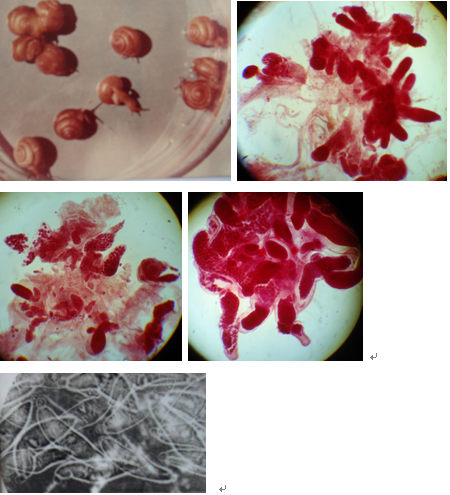  p>见于吸虫纲的复殖类发育中,是继毛蚴之后,相当于单性虫(parthenit