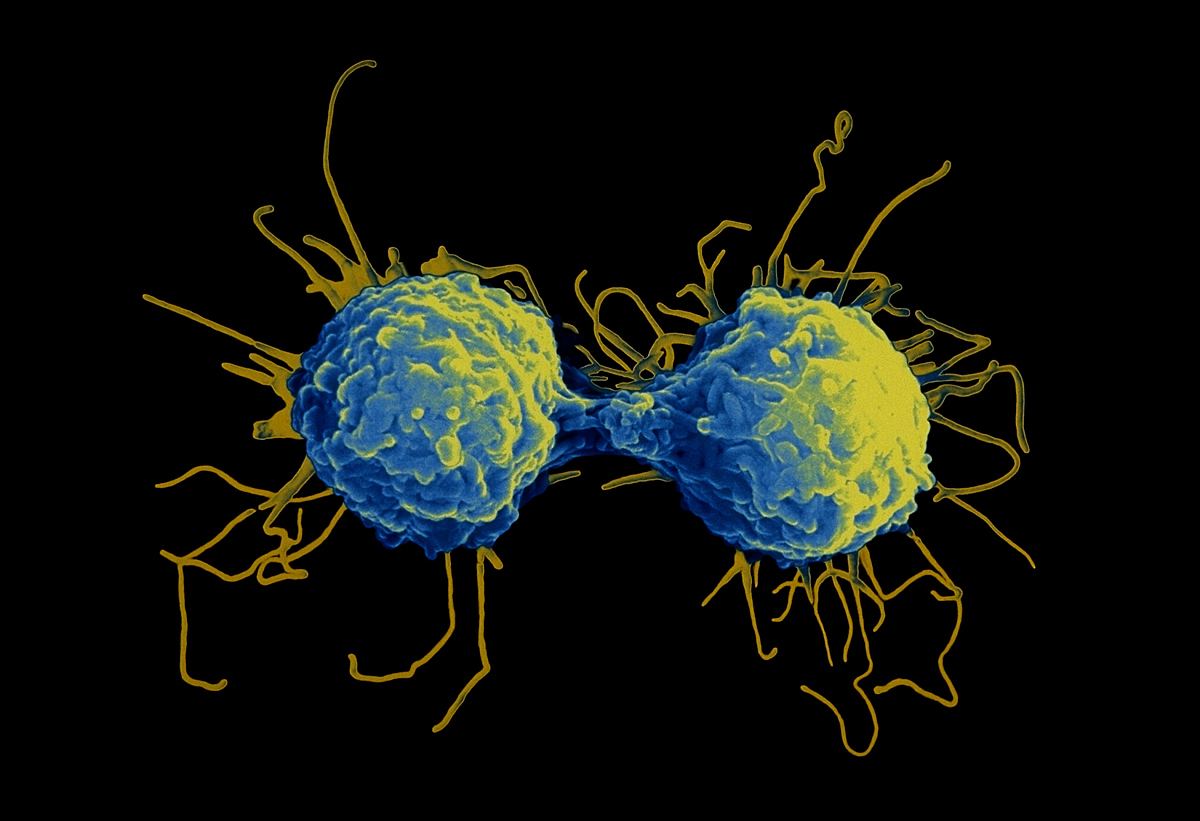 细胞毒性t淋巴细胞