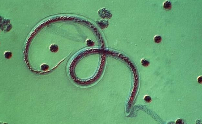 舌状绦虫的<a href="#" data