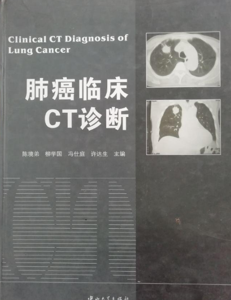 肺癌临床ct诊断