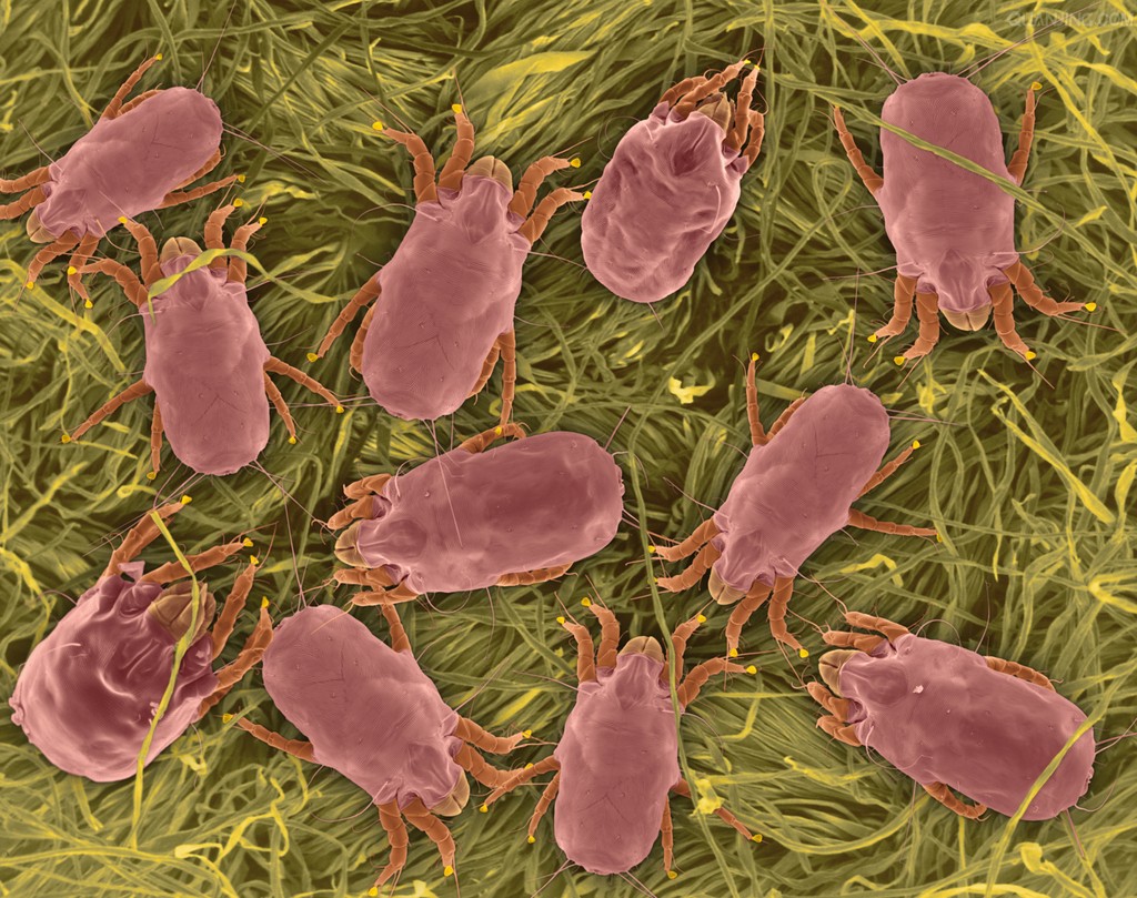 blank" href="/item/沙螨">沙螨科纤沙螨属的一种螨虫