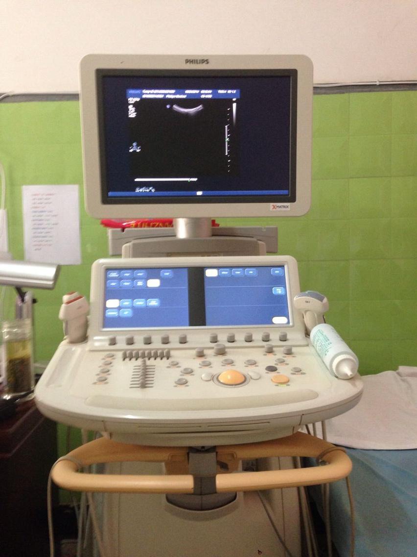 彩色多普勒超声心动图