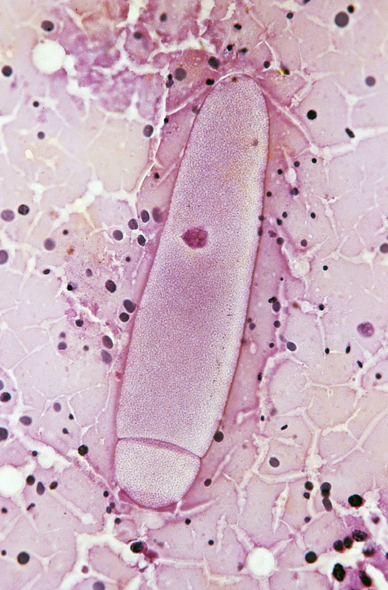  p>簇虫, a target="_blank" href="/item/孢子纲/3640974" data