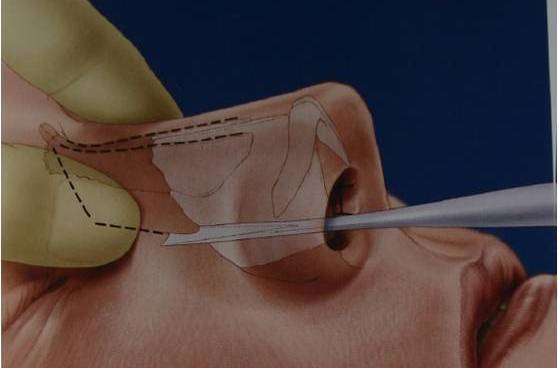 鼻骨上接额骨,下接鼻软骨,外侧接上颌骨,内侧接对侧鼻骨.