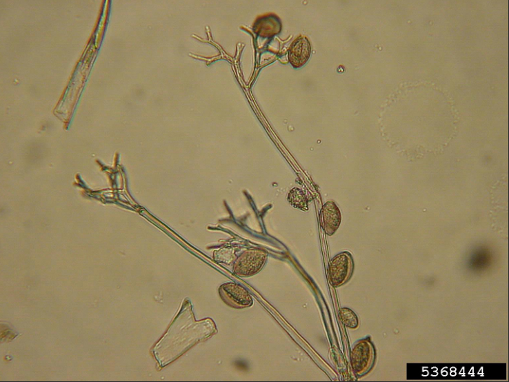  p>佛手瓜霜霉病是由古巴假霜霉引起的,发生在 a target="_blank"