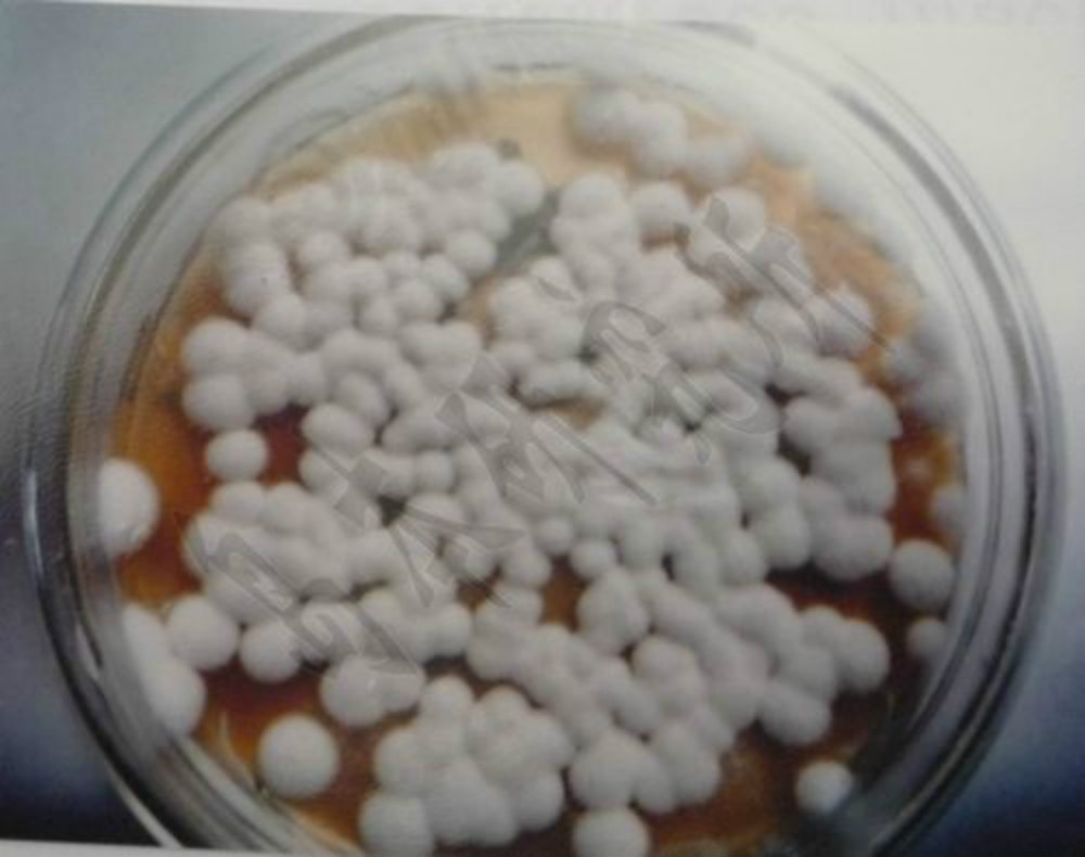  p>淡紫拟青霉((paecilomyces lilacinus(thorn.