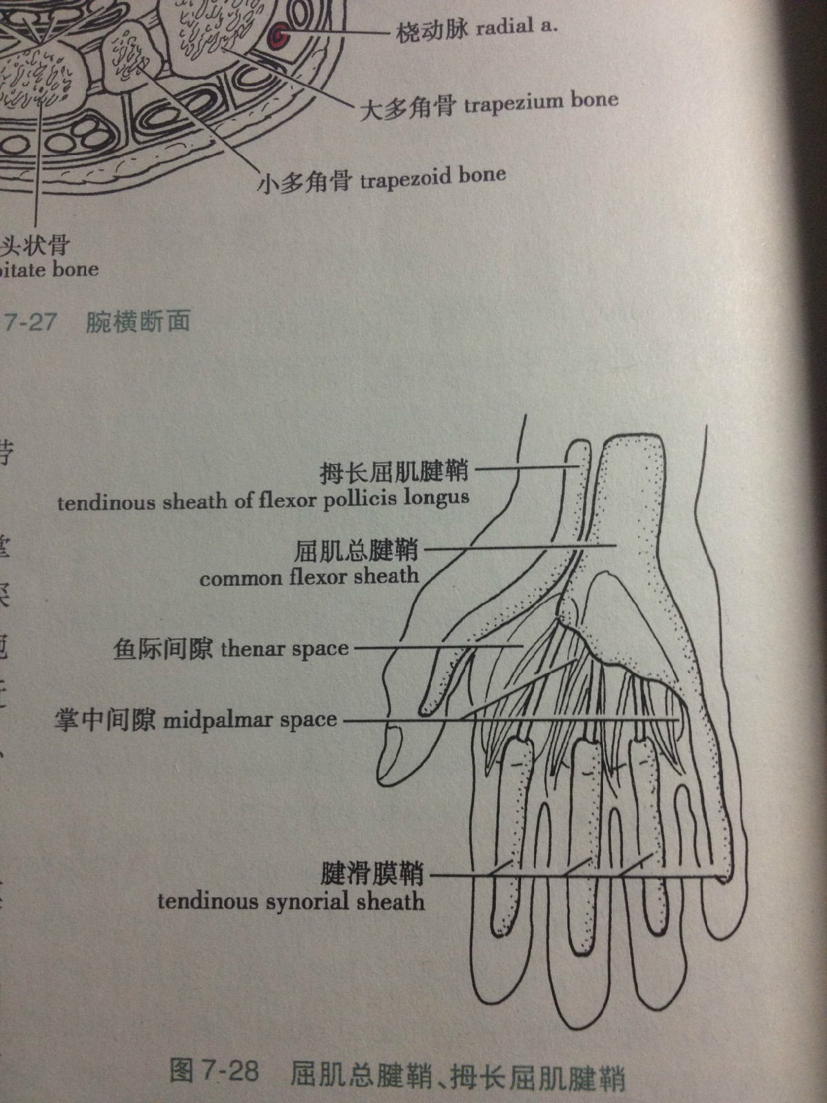  p>局部解剖学结构,桡侧囊 b>/ /b>拇长屈肌腱鞘 /p>