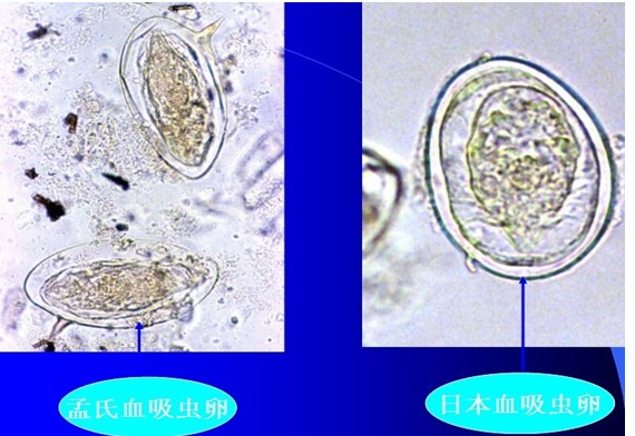 吸虫病 /a>俗称 a target="_blank" href="/item/血吸虫病/733157"
