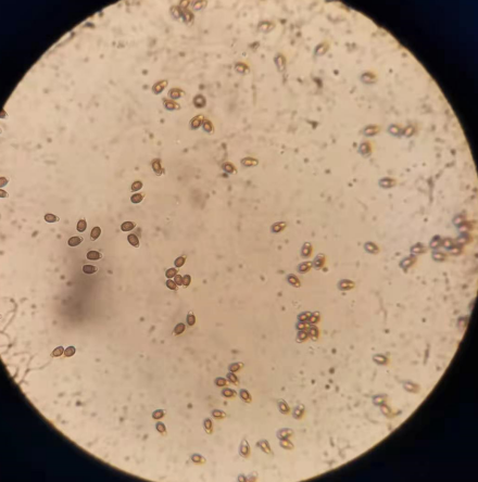 显微镜下灵芝孢子粉灵芝孢子粉为椭圆型,只有4-6个微米.