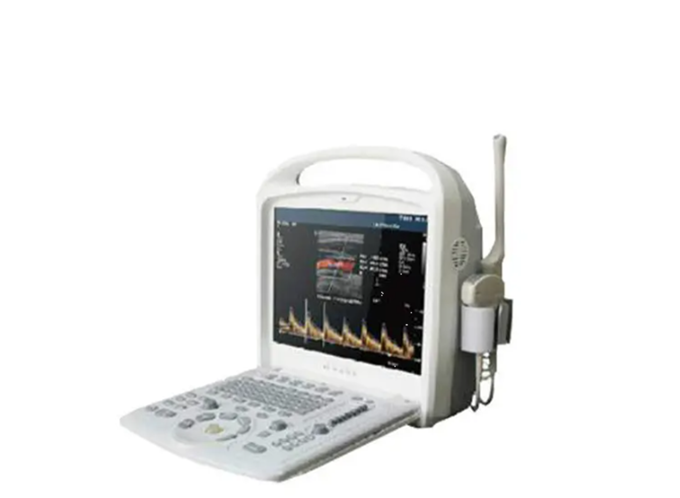 便携式b型超声诊断仪