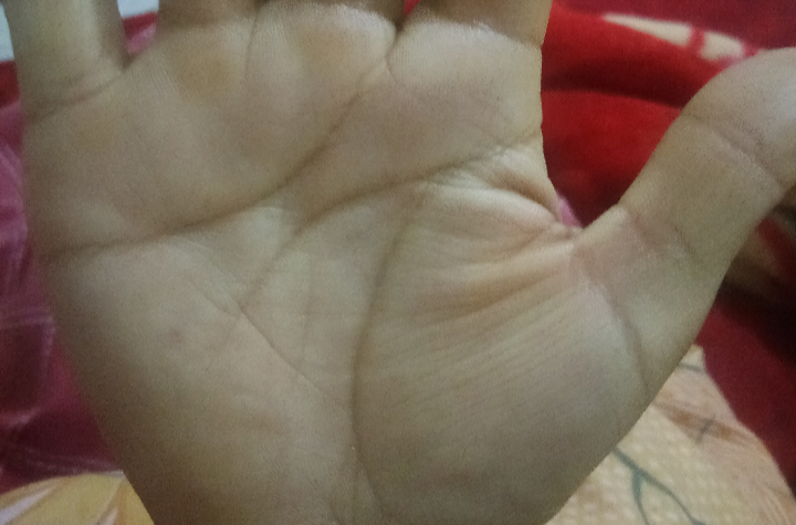  p>财运线又名 a href="#" data-lemmaid="2441078">水星线 /a>是出于