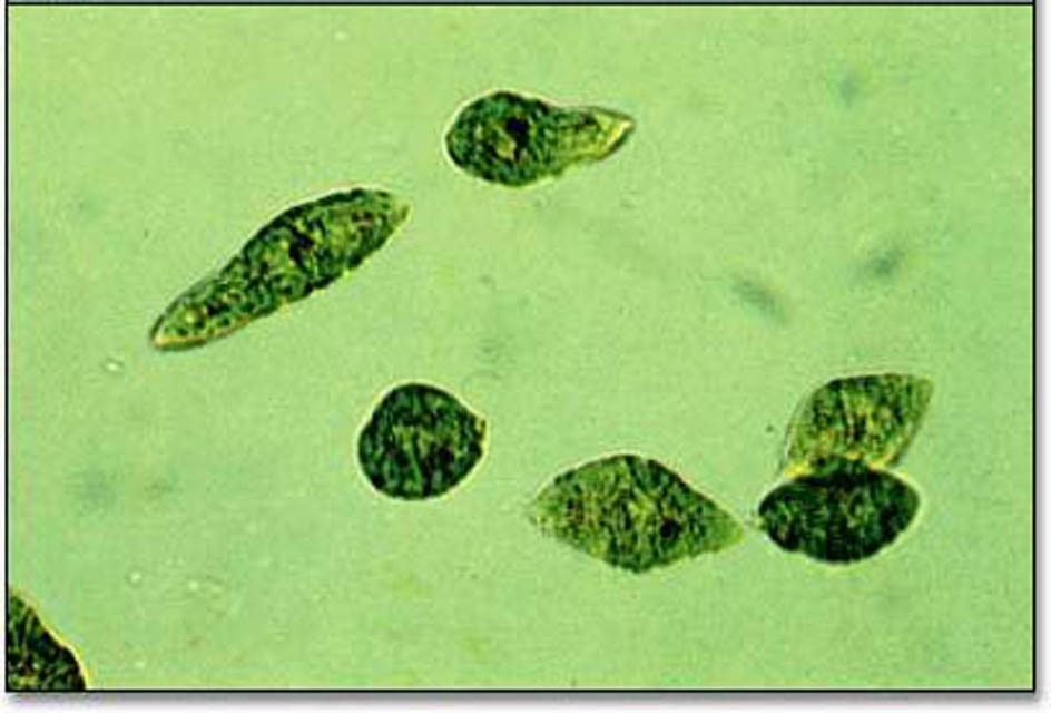  p>裸藻门,除胶柄藻属外,都是无细胞壁,有鞭毛,能自由游动的单细胞