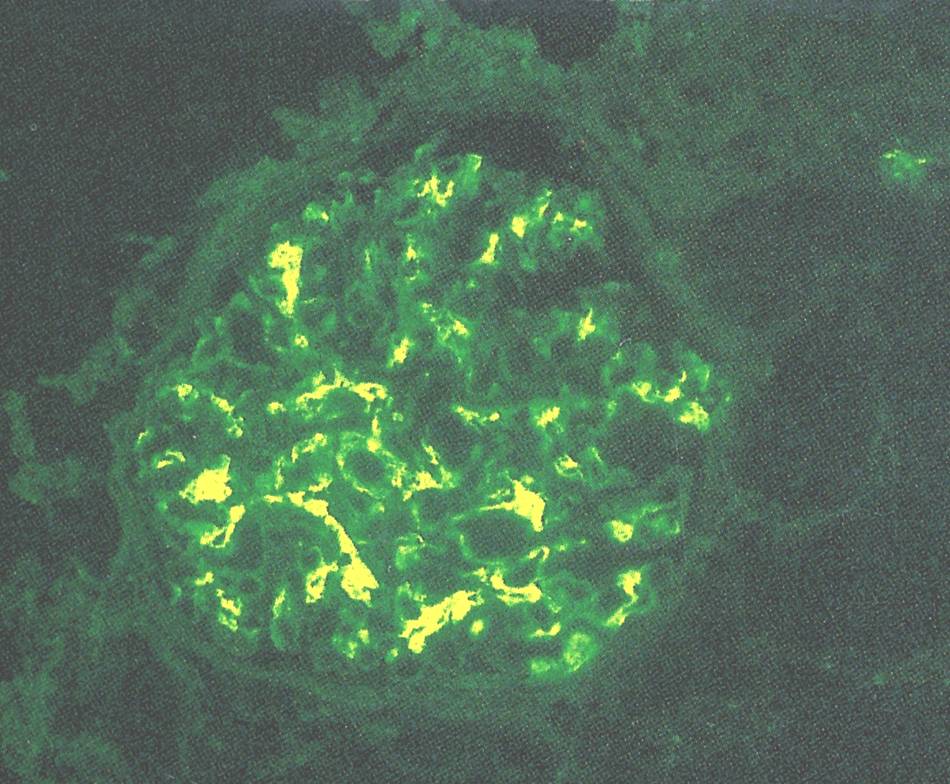  p>(immunoglobulin a, iga)免疫球蛋白 a 在正常人血清中的含量