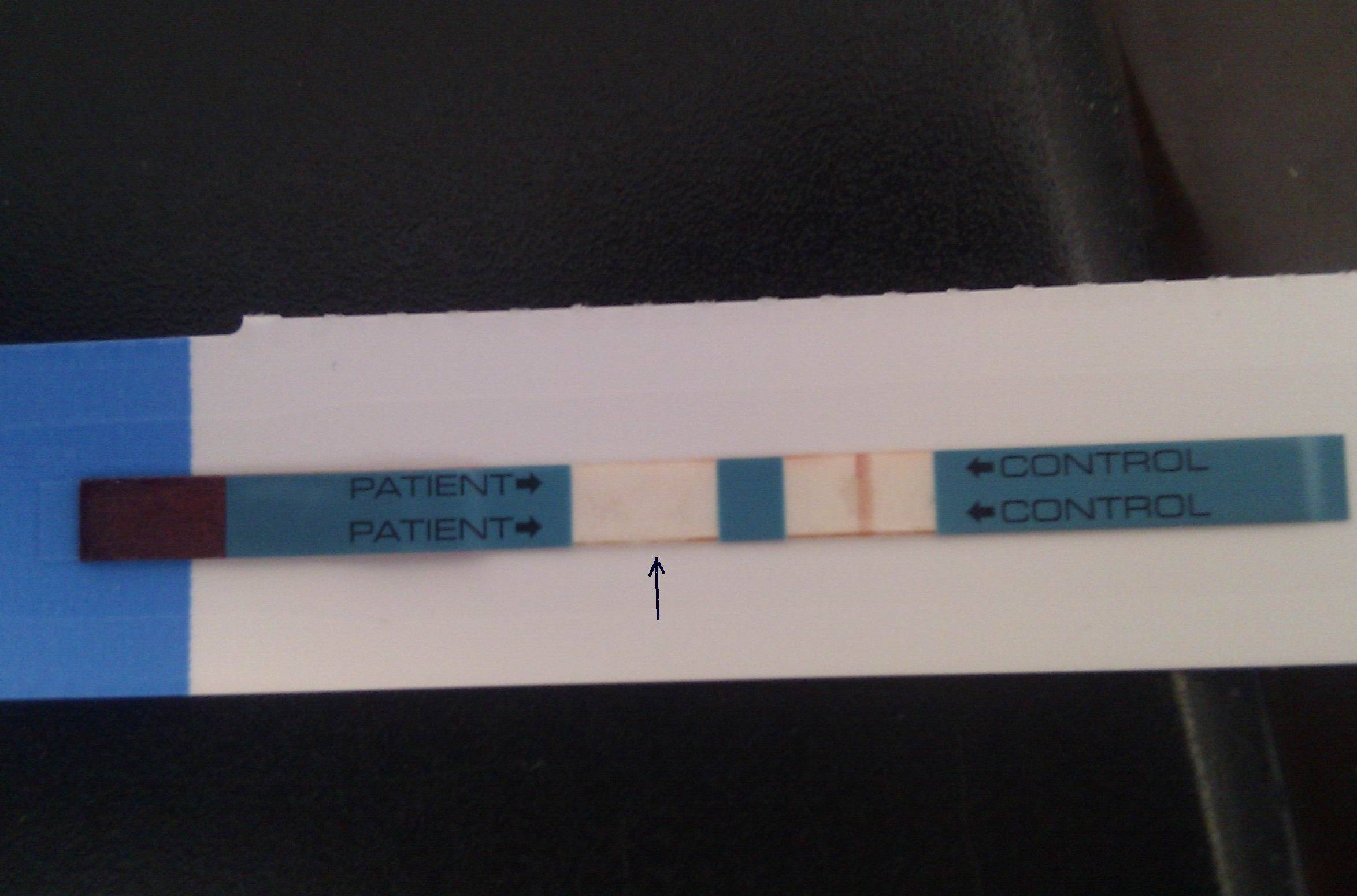 艾滋病检测艾滋病试纸