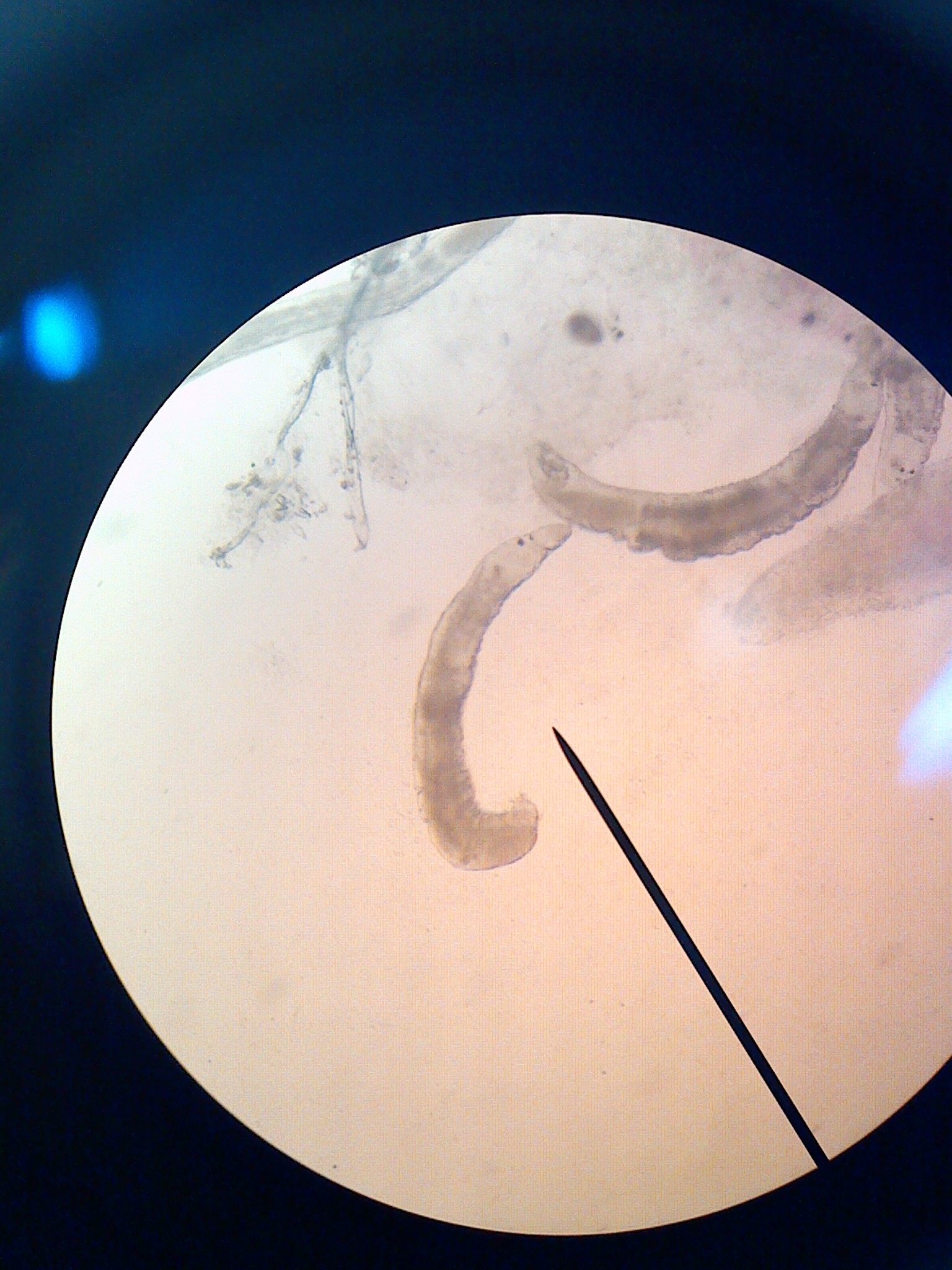 鳗鱼拟指环虫病
