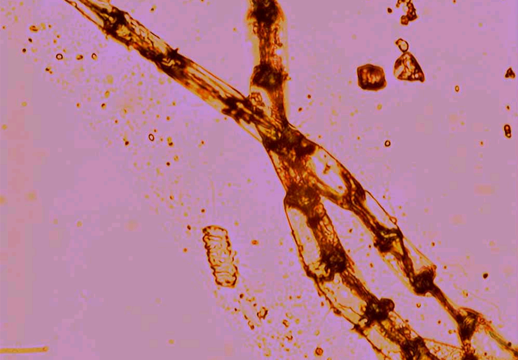  p data-id="gnazxe097g">丝藻属是绿藻门丝藻目,该属有25种以上,中国