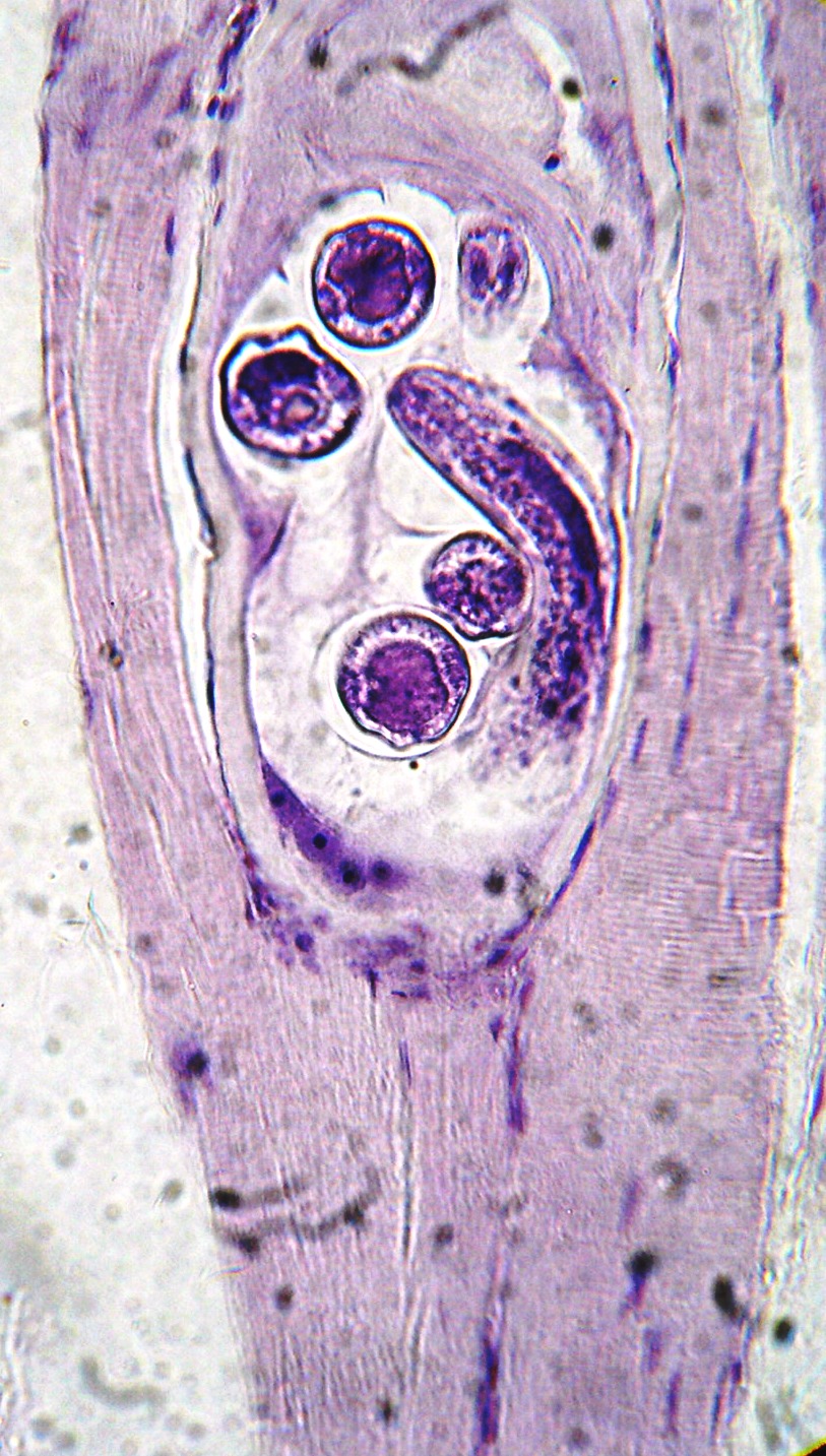  p>旋毛虫 a href="#" data-lemmaid="2697752">幼虫寄生 /a>于肌纤维