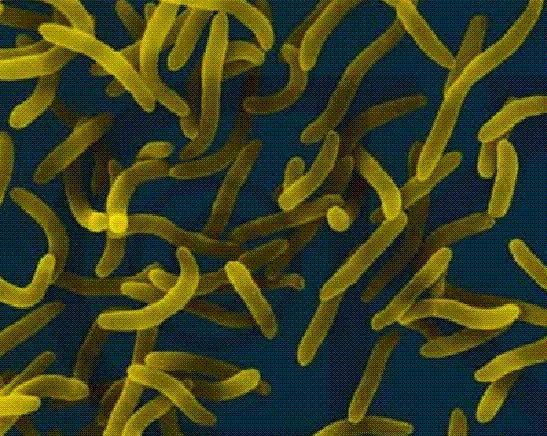 vibrio parahemolyticus