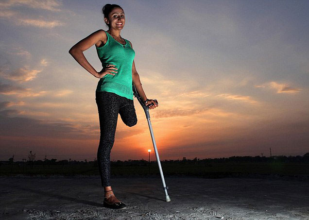 一条腿,但酷爱舞蹈的她没有放弃自己的舞蹈梦想,她不仅练习独腿走路