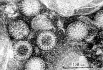  p>人类轮状病毒(rotavirus)是 a target="_blank" href="/item/婴幼