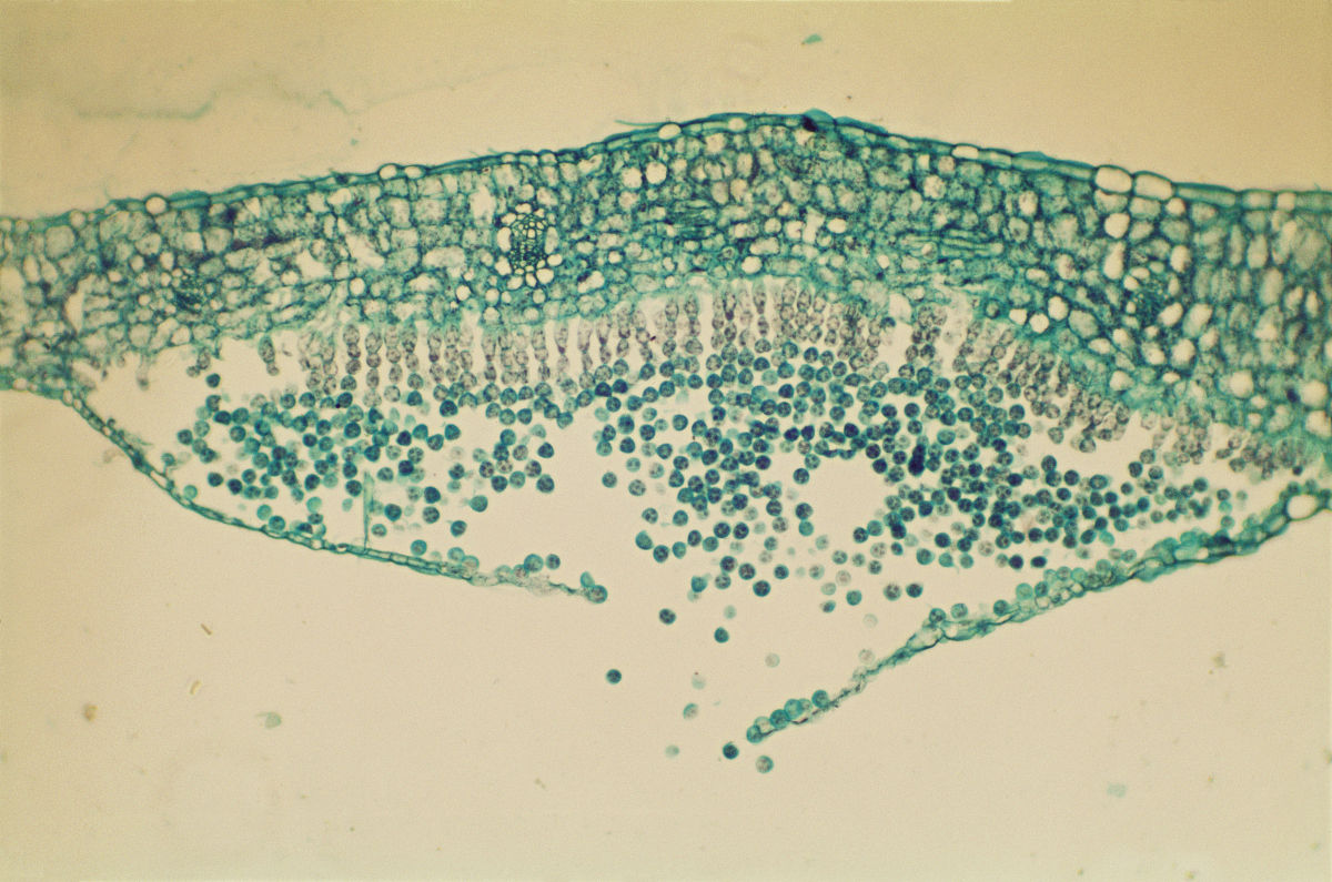 白色假丝酵母菌