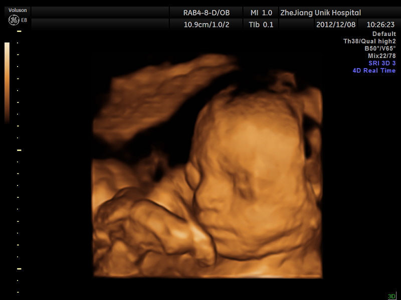  p>优你可妇科门诊部是杭城为数不多的同时拥有三维,四维彩超的医疗