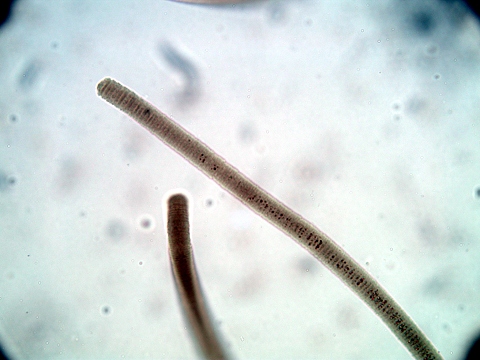  p>蓝藻是最简单,也是最原始的绿色自养植物类群.