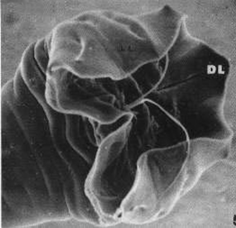 十二指肠钩口线虫